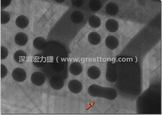 BGA因?yàn)楹笁|變小，造成錫膏過多而最終形成焊接短路的結(jié)果。